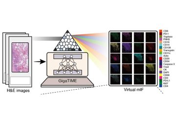 A schematic of GigaTIME illustrating how the AI model translates pathology images into virtual multiplex immunofluorescence images