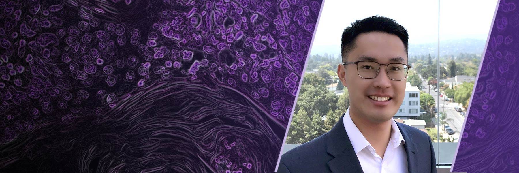 Magnifying glass resting on a laptop keyboard reflecting the light of the keys and screen